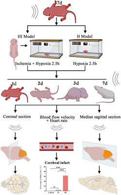 Transcranial Doppler Ultrasonography detection on cerebrovascular flow for evaluating neonatal hypoxic-ischemic encephalopathy modeling